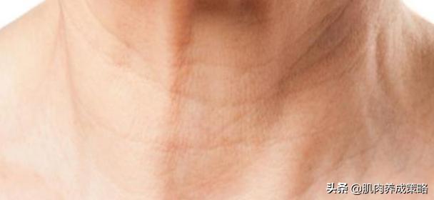 脖子长颈纹怎么去除,人脖子长皱纹用什么方法
