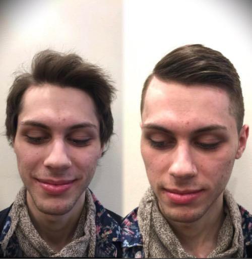 沙宣洗发水不去屑,沙宣洗发水掉发又油