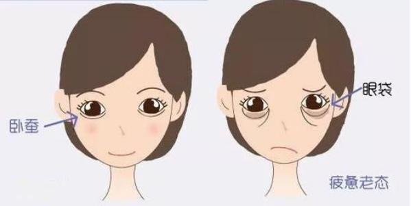 眼袋和卧蚕的区别教你区分小妙招,卧蚕和眼袋傻傻分不清的说说