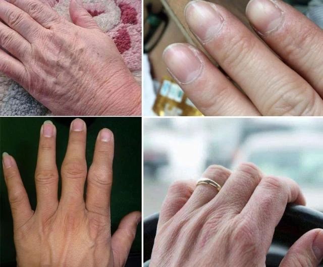 手模是怎么保护手的,手模是用什么做的