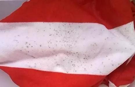怎样去除衣物上的霉味霉斑和黑点,去除衣物霉味最有效的方法