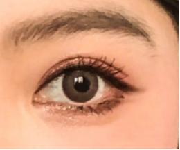 眼睛下眼睑放大,眼睛看东西缩小很多倍