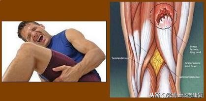 肌肉紧张拉伸的话术,觉得肌肉紧张