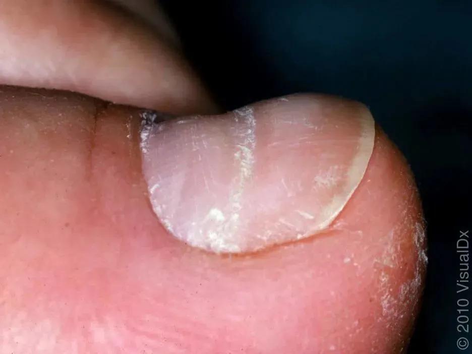 想让指甲长得快些怎么办,想让指甲变好看怎么办