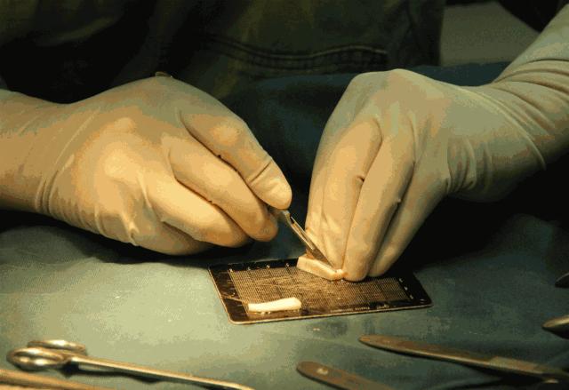 隆鼻方法,隆鼻比较好的方法