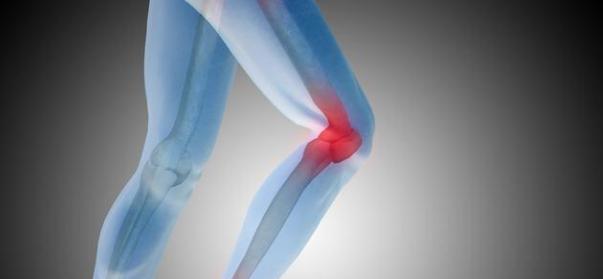 跑完步膝盖疼是怎么回事如何缓解,跑完步后膝盖痛应该怎么解决