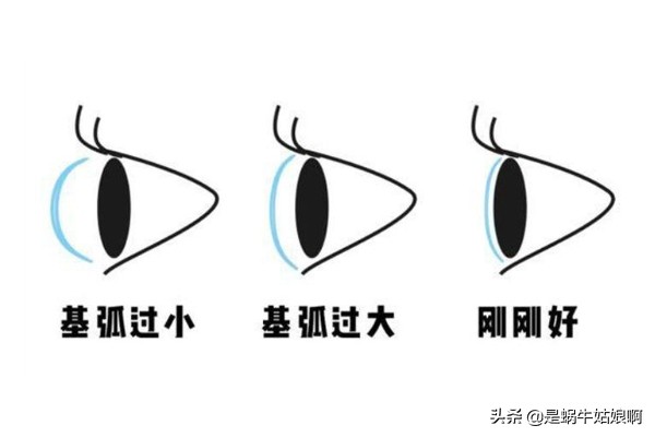 美瞳选不好会瞎的千万别乱选,美瞳不踩坑指南