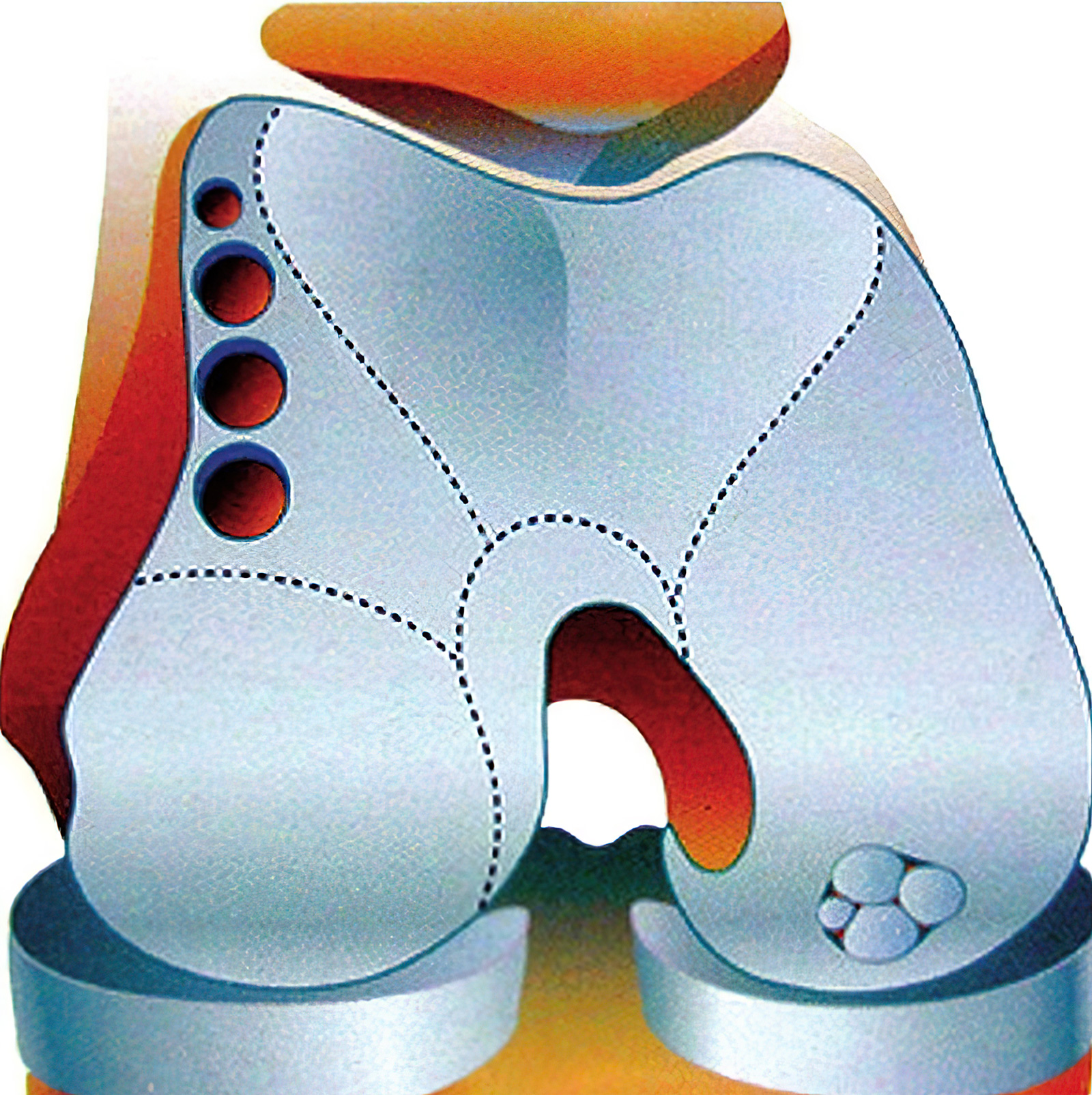 膝关节骨关节炎怎样手术能治好,膝关节镜能治好关节炎吗