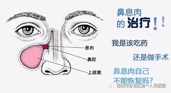 医院耳鼻喉科可以看鼻息肉么,江苏省人民医院耳鼻喉科鼻息肉