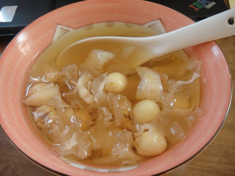 失眠有四种情况,急慢性失眠时间区别