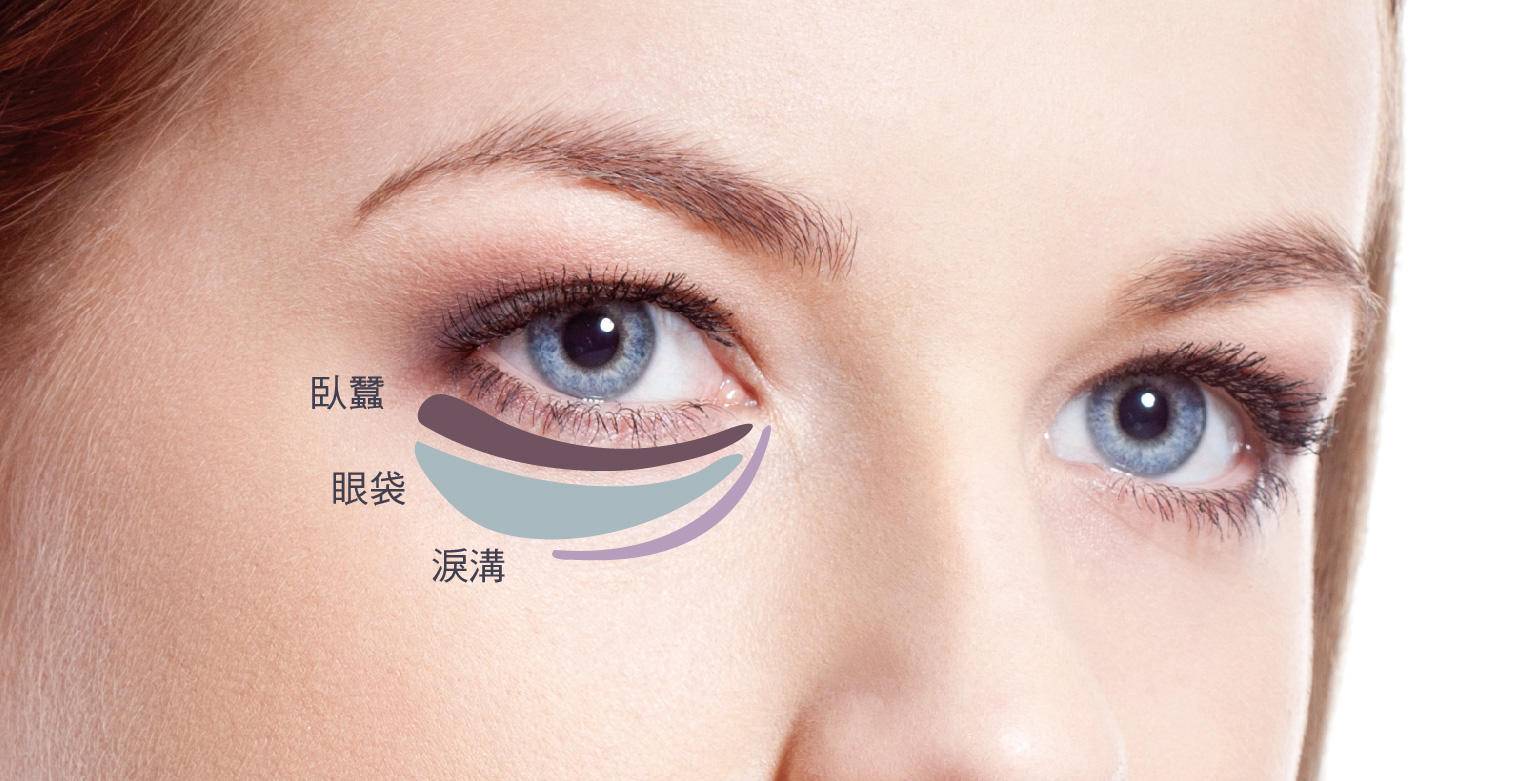 下眼袋黑跟熊猫眼一样是怎么回事,熬夜熊猫眼加重眼袋