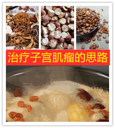 查出子宫有小肌瘤注意什么饮食,子宫肌瘤的四个常用诊断方法