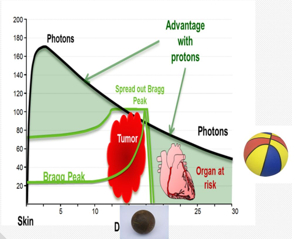 被誉为“抗癌神器”的质子治疗,这几类患者最适合