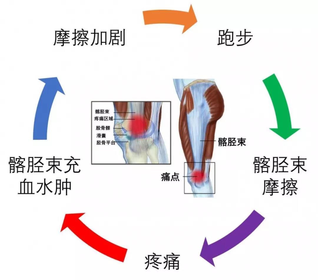 跑步后腿疼脚疼是怎么回事,跑步后腿脚痛如何缓解