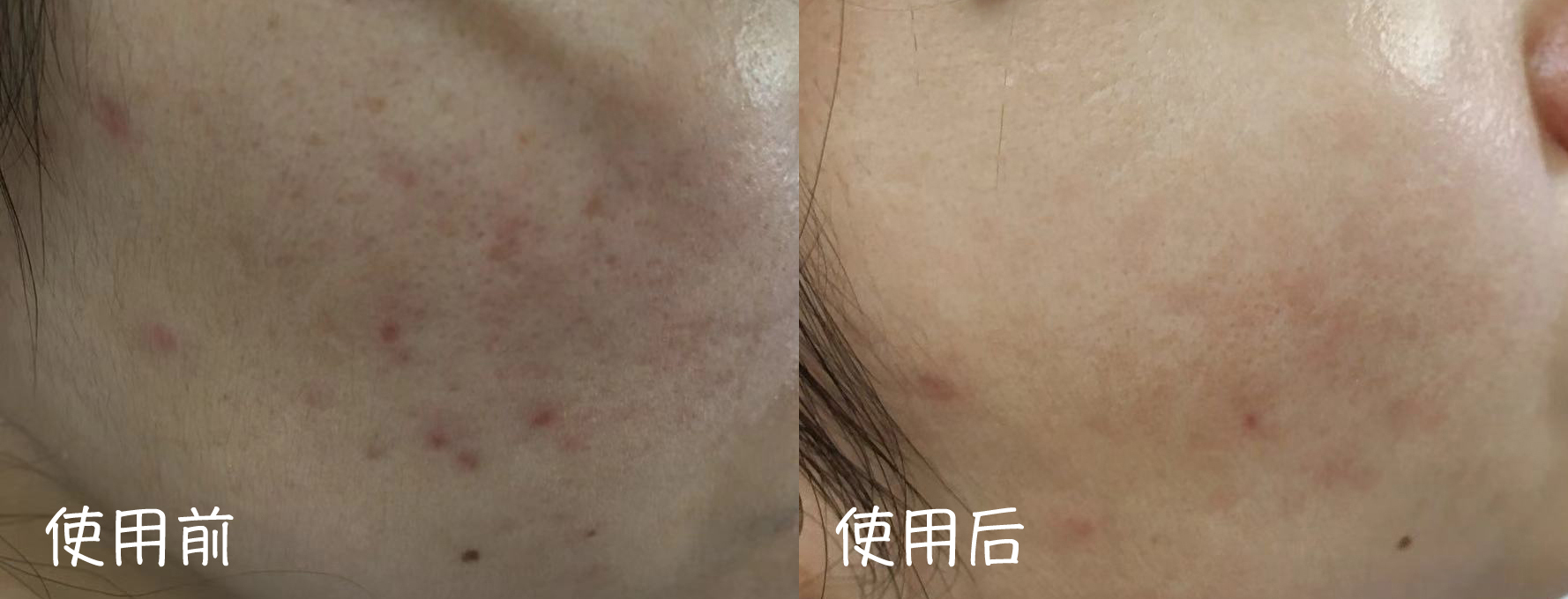 堪比科颜氏白泥的其他护肤品,堪比科颜氏精华