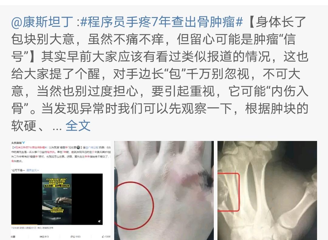 手上长个包不痛不痒会不会是肿瘤,手上长了个肿块