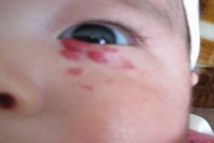 宝宝体重太轻怎么办,宝宝体重减轻不长肉