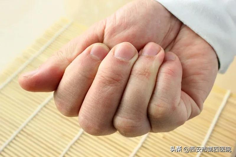 如何挑选枸杞最好的,最好的枸杞挑选方法