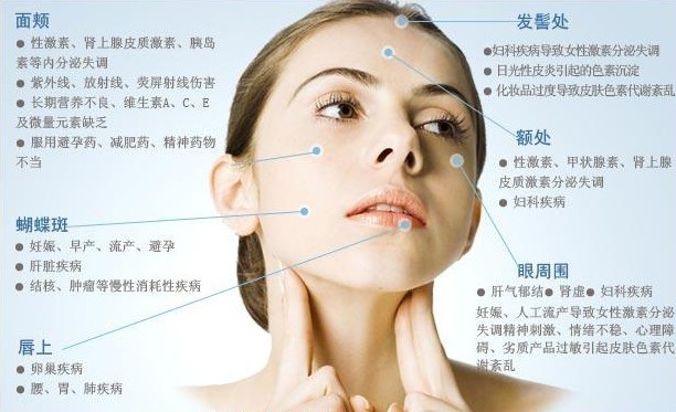 褐斑是怎么引起的,怎么预防长褐斑