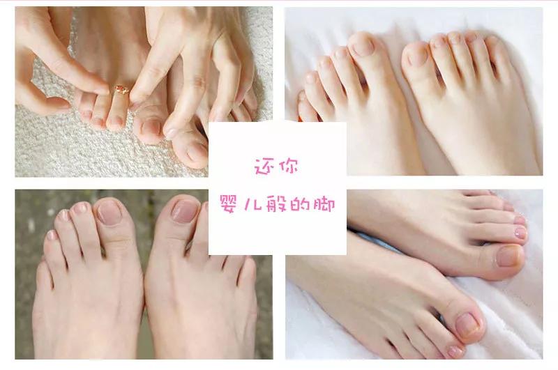 加拿大皲裂霜,加拿大修复膏