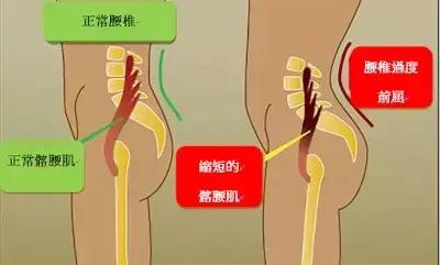 锻炼髂腰肌最有效方法图解,不懂健身动作练到的肌肉