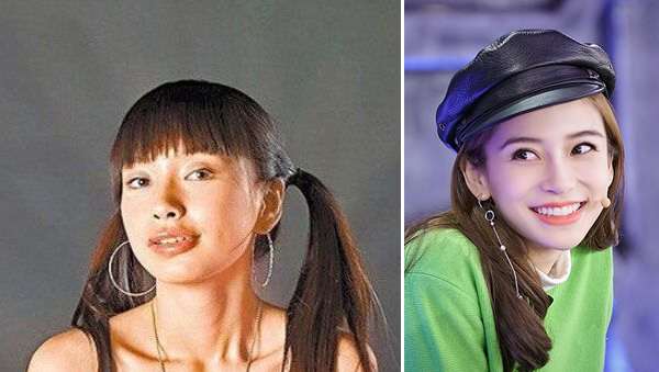 阿娇大龅牙,阿娇整牙