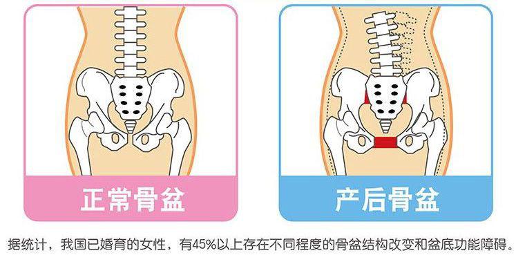 产后睡觉平躺时间长不敢翻身腰疼,产后腰疼不能平躺是怎么回事