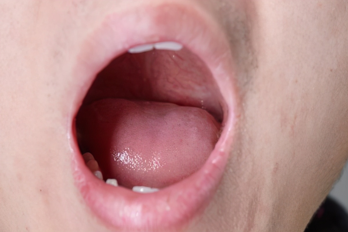 脑梗前兆症状ct检查得出来吗,脑部ct显示有脑梗病灶是什么意思