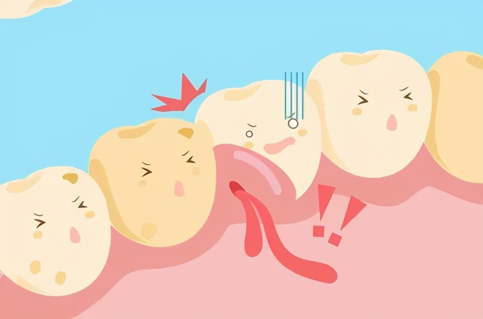 孕期可以去看牙整牙吗,为什么医生不建议孕妇看牙