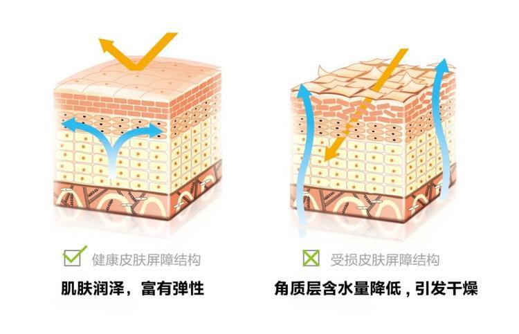脸要不要去角质,脸部有必要去角质么