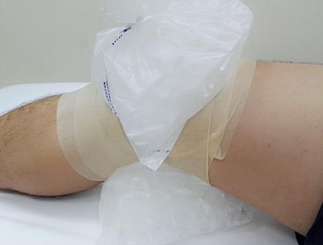 网球肘有好的治疗方法吗,网球肘有哪些治疗方法