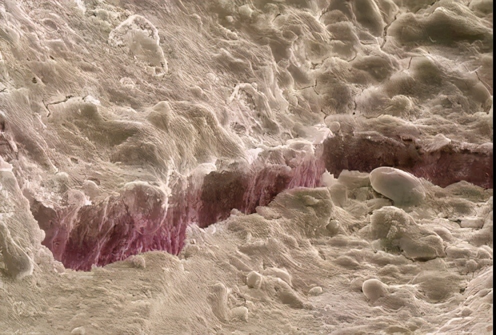 没蛀牙但是牙痛牙龈肿,没蛀牙只是牙髓炎怎么治疗