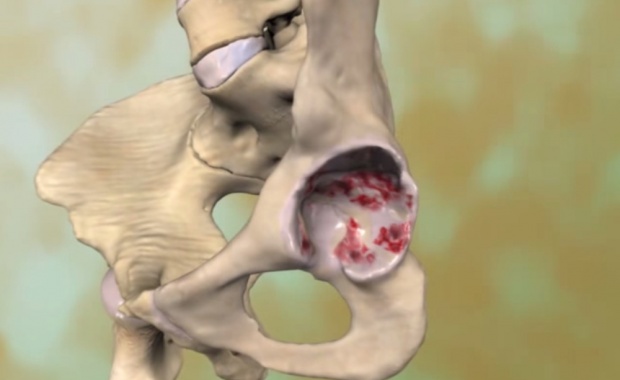 影响人类健康四大慢性病,影响最广的十大疾病