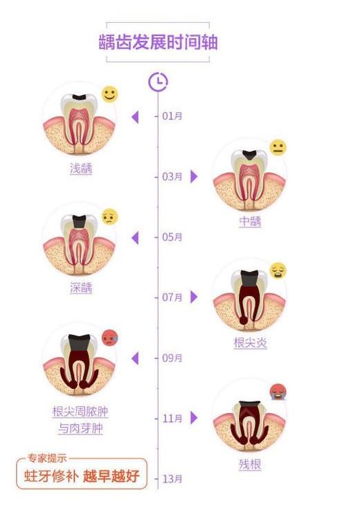 根管治疗和补牙哪个更贵,根管和补牙戴全瓷牙冠一共多少钱