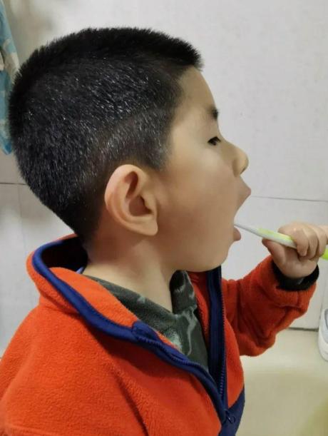 四岁儿童有黑牙怎么办,3岁儿童满口小黑牙元凶并不是糖