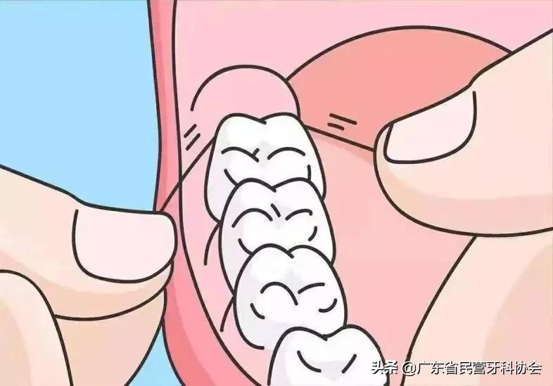 如何正确使用牙线清理牙齿,牙线的正确使用方法丁香医生