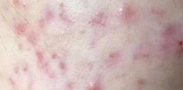 皮肤还是很粗糙,想要养成好皮肤要注意以下三点