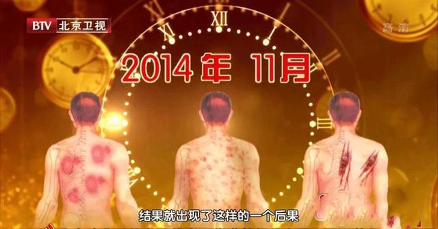 全身痒是糖尿病还是肝脏问题,皮肤瘙痒和血糖有关系吗