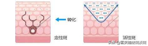 去斑点的最好方法淡斑精华,去斑点的最好方法淡斑