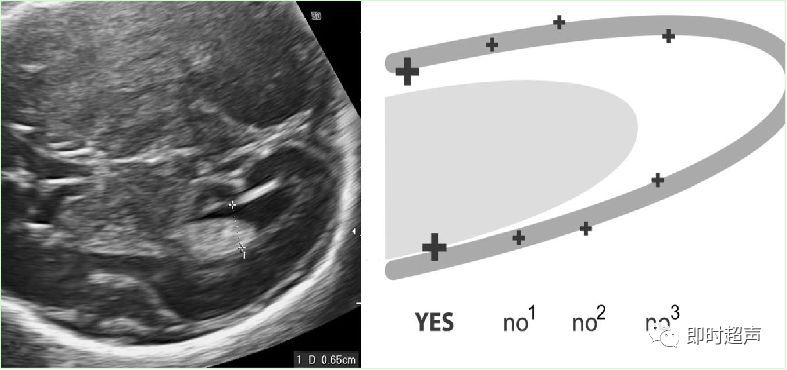 产科常规彩色超声报告单介绍,常见妇科疾病超声报告