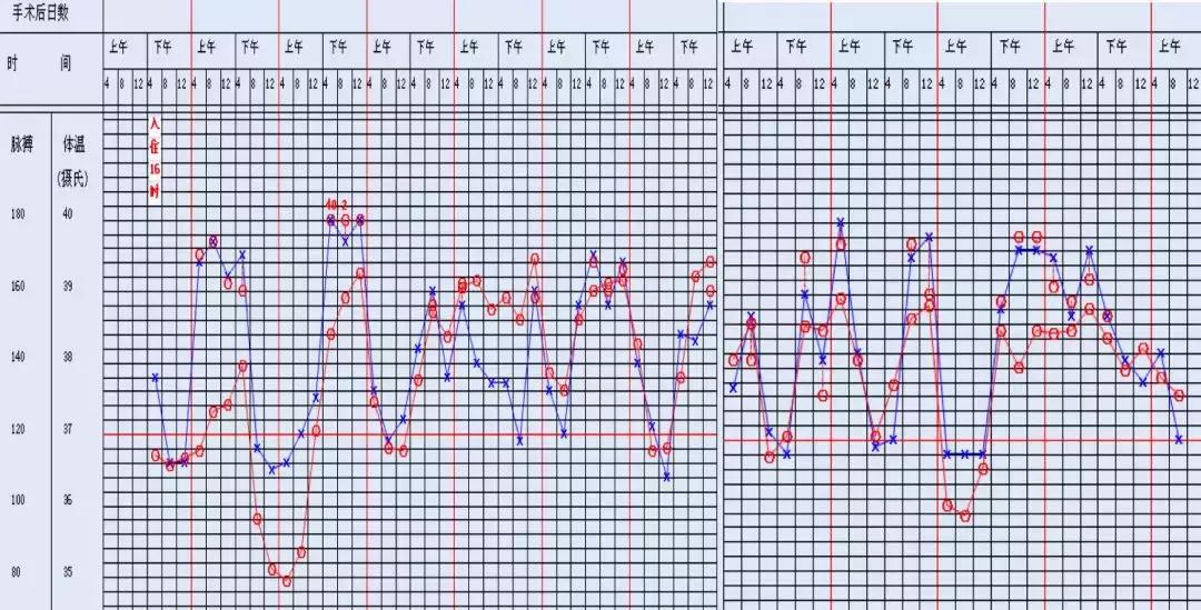 万古霉素用于mrsa的作用机制,万古霉素无效还有什么抗生素可用