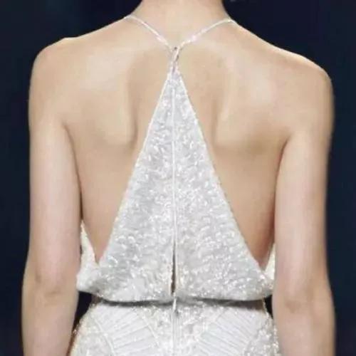 蝴蝶骨最好的矫正方法,蝴蝶骨是不良体态吗