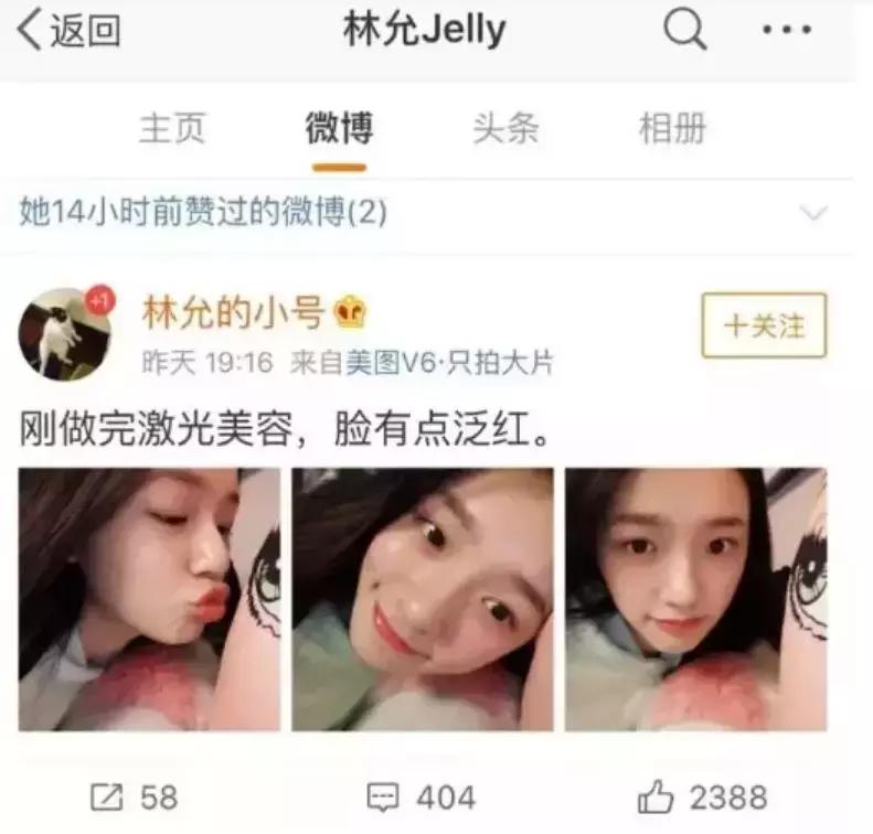 激光美容都能改善什么,关于激光美容的6个误区