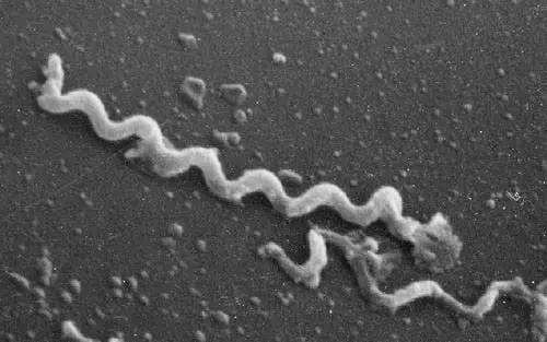 日本2019年传染病实况：为什么得梅毒的孕妇越来越多？女人站过街，男人出过轨，新生儿先天梅毒