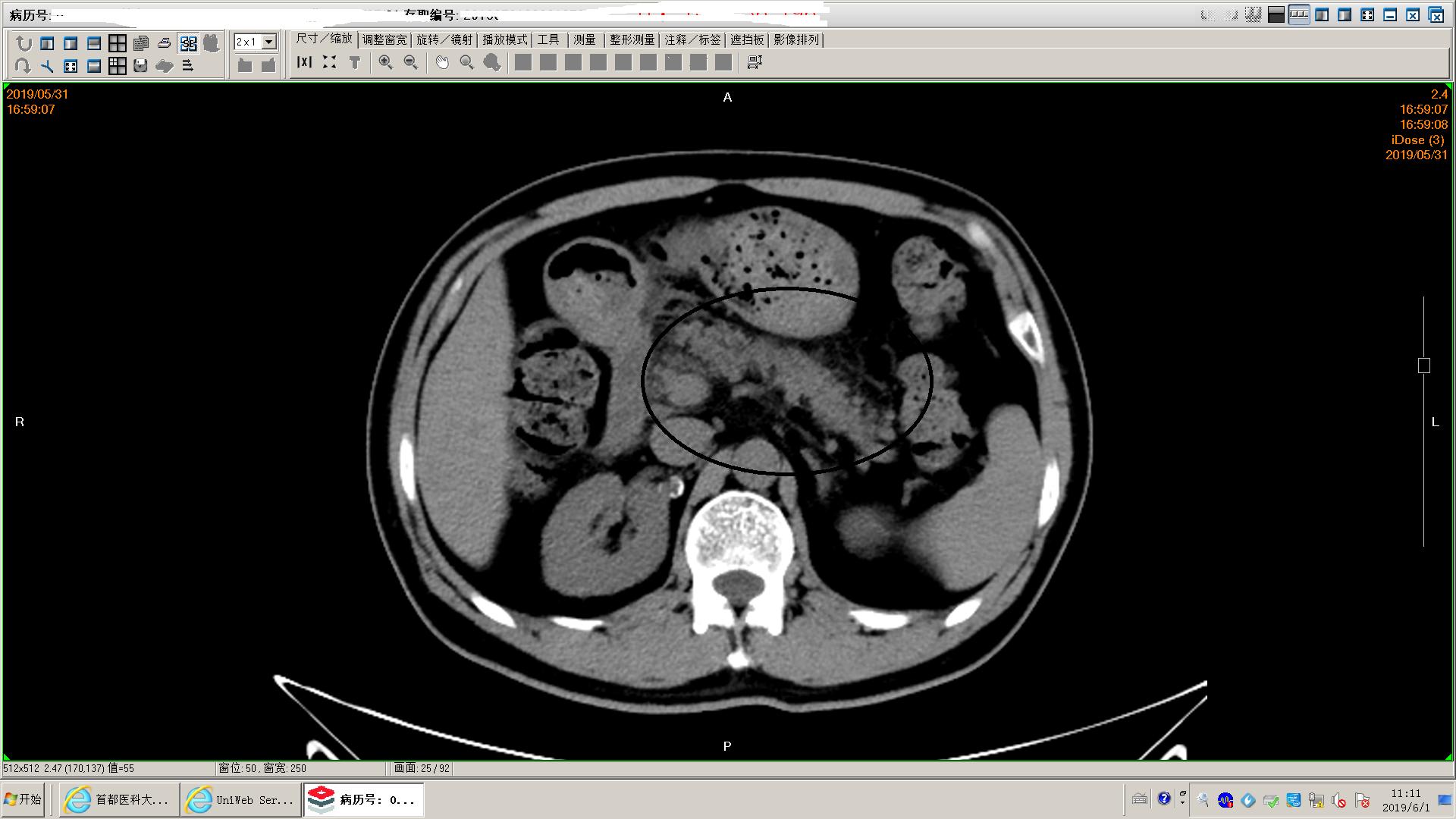 狗得了胰腺炎怎么办,狗得了胰腺炎治疗