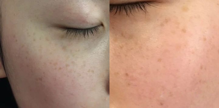 拒绝斑点不做斑点女孩,拒绝纹身女生