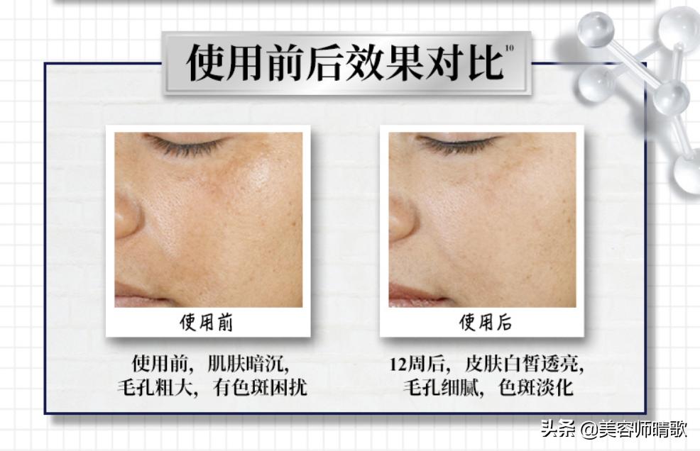 小白瓶淡斑精华推荐,淡斑小白瓶精华