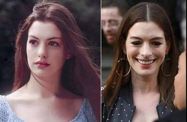 法令纹显老10岁三种方法帮助改善,最显老的法令纹怎么改善