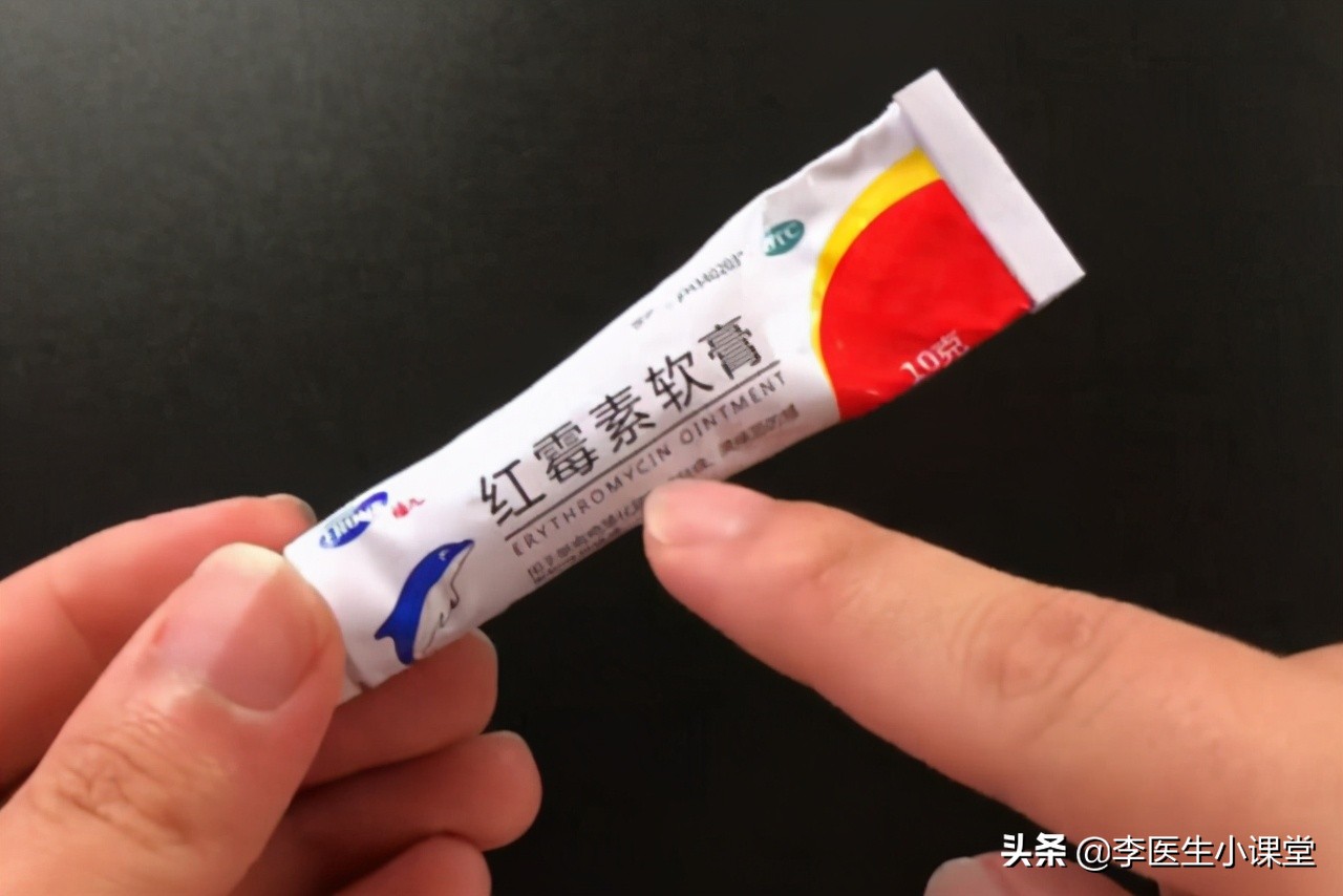 红霉素软膏治什么病最好用,红霉素软膏具体能治什么病