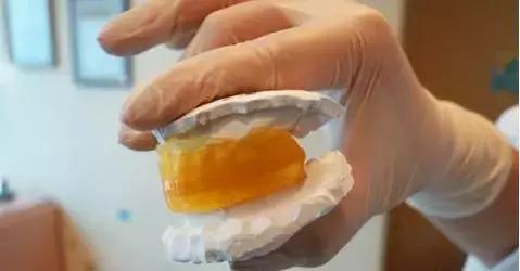 儿童mrc肌功能矫正费用,mrc肌功能矫正